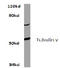 Tubulin Gamma 1 antibody, AP06470PU-N, Origene, Western Blot image 