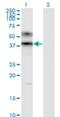 ADP-Ribosyltransferase 3 antibody, H00000419-M09, Novus Biologicals, Western Blot image 