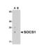 Suppressor Of Cytokine Signaling 1 antibody, MBS150861, MyBioSource, Western Blot image 