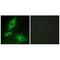 Lymphotoxin Beta Receptor antibody, A00942, Boster Biological Technology, Immunofluorescence image 