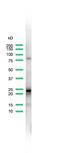 Rho GDP Dissociation Inhibitor Beta antibody, PA5-32377, Invitrogen Antibodies, Western Blot image 