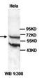 Sp3 Transcription Factor antibody, orb77358, Biorbyt, Western Blot image 