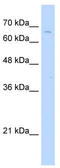 Transketolase Like 2 antibody, TA346850, Origene, Western Blot image 