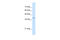 Serine/Threonine Kinase Receptor Associated Protein antibody, 30-347, ProSci, Western Blot image 