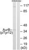 Aurora Kinase B antibody, LS-C198661, Lifespan Biosciences, Western Blot image 
