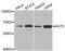 Lysine Acetyltransferase 5 antibody, STJ28062, St John