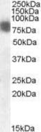 Cortactin antibody, PA1-31469, Invitrogen Antibodies, Western Blot image 