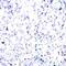 RB Transcriptional Corepressor 1 antibody, 79-322, ProSci, Immunohistochemistry paraffin image 