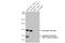 Androgen Receptor antibody, GTX636021, GeneTex, Western Blot image 