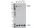 E3 ubiquitin-protein ligase TRIM37 antibody, 96167S, Cell Signaling Technology, Western Blot image 