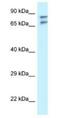 TNFAIP3 Interacting Protein 1 antibody, NBP1-79900, Novus Biologicals, Western Blot image 
