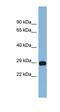 NADH:Ubiquinone Oxidoreductase Core Subunit S3 antibody, orb330865, Biorbyt, Western Blot image 