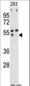 Matrix Metallopeptidase 12 antibody, LS-C100442, Lifespan Biosciences, Western Blot image 