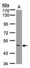 NOVA Alternative Splicing Regulator 1 antibody, orb73892, Biorbyt, Western Blot image 
