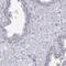 MAGE Family Member B4 antibody, PA5-56478, Invitrogen Antibodies, Immunohistochemistry paraffin image 