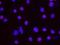 SDS3 Homolog, SIN3A Corepressor Complex Component antibody, NB100-257, Novus Biologicals, Proximity Ligation Assay image 