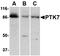 Protein Tyrosine Kinase 7 (Inactive) antibody, orb74869, Biorbyt, Western Blot image 