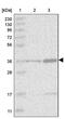 TRNA Aspartic Acid Methyltransferase 1 antibody, PA5-57884, Invitrogen Antibodies, Western Blot image 