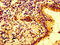Interferon Gamma Receptor 2 antibody, LS-C670500, Lifespan Biosciences, Immunohistochemistry paraffin image 