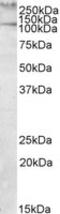 Talin 1 antibody, TA305932, Origene, Western Blot image 