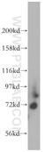 Potassium Voltage-Gated Channel Subfamily D Member 1 antibody, 13768-1-AP, Proteintech Group, Western Blot image 