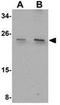 Coiled-Coil Domain Containing 134 antibody, GTX85268, GeneTex, Western Blot image 