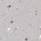 Sperm Acrosome Associated 1 antibody, NBP1-80792, Novus Biologicals, Western Blot image 