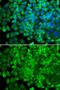 Galactosidase Alpha antibody, GTX32617, GeneTex, Immunofluorescence image 