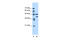 Eukaryotic Translation Elongation Factor 1 Gamma antibody, 30-371, ProSci, Western Blot image 