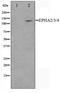 EPH Receptor A2 antibody, TA347325, Origene, Western Blot image 