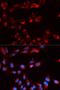 Complement Factor Properdin antibody, LS-B13878, Lifespan Biosciences, Immunofluorescence image 