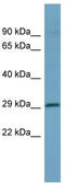 Homeobox D1 antibody, TA344560, Origene, Western Blot image 