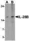 Interferon Lambda 3 antibody, LS-C201131, Lifespan Biosciences, Western Blot image 