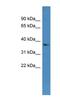 Dehydrogenase/Reductase 7 antibody, NBP1-68913, Novus Biologicals, Western Blot image 