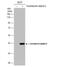 ArfGAP With Dual PH Domains 2 antibody, NBP1-31076, Novus Biologicals, Western Blot image 