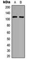 Serine/threonine-protein phosphatase 4 regulatory subunit 1 antibody, MBS8240303, MyBioSource, Western Blot image 