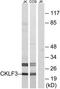 CKLF Like MARVEL Transmembrane Domain Containing 3 antibody, TA316070, Origene, Western Blot image 