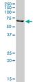 Protein Arginine Methyltransferase 3 antibody, H00010196-M16, Novus Biologicals, Western Blot image 