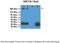 ATP Binding Cassette Subfamily C Member 9 antibody, 25-884, ProSci, Enzyme Linked Immunosorbent Assay image 