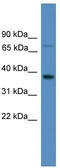 Olfactory Receptor Family 1 Subfamily S Member 1 (Gene/Pseudogene) antibody, TA342702, Origene, Western Blot image 