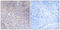 Mitochondrial Ribosomal Protein L11 antibody, LS-C119620, Lifespan Biosciences, Immunohistochemistry paraffin image 