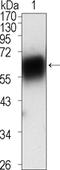 Receptor Tyrosine Kinase Like Orphan Receptor 1 antibody, M03192, Boster Biological Technology, Western Blot image 