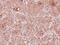 Tropomodulin 2 antibody, NBP2-20730, Novus Biologicals, Immunohistochemistry paraffin image 