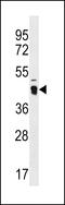 ATPase Family AAA Domain Containing 3C antibody, 60-214, ProSci, Western Blot image 