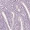 Nucleoporin 210 Like antibody, HPA064245, Atlas Antibodies, Immunohistochemistry paraffin image 