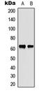 Checkpoint Kinase 2 antibody, LS-C358943, Lifespan Biosciences, Western Blot image 