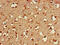 BAI1 Associated Protein 2 antibody, CSB-PA891988LA01HU, Cusabio, Immunohistochemistry paraffin image 