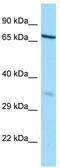 HAUS Augmin Like Complex Subunit 3 antibody, TA333680, Origene, Western Blot image 