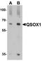 Quiescin Sulfhydryl Oxidase 1 antibody, A04549, Boster Biological Technology, Western Blot image 