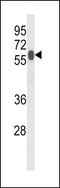 2-Hydroxyacyl-CoA Lyase 1 antibody, LS-C163695, Lifespan Biosciences, Western Blot image 